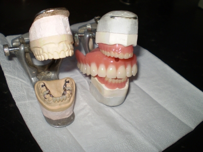 Kombinált fogpotlás